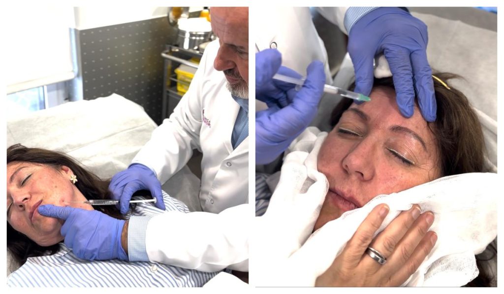 Aplicación de neuromoduladores y ácido hialurónico durante un tratamiento de rejuvenecimiento facial para mejorar las arrugas de expresión y redefinir el óvalo facial.